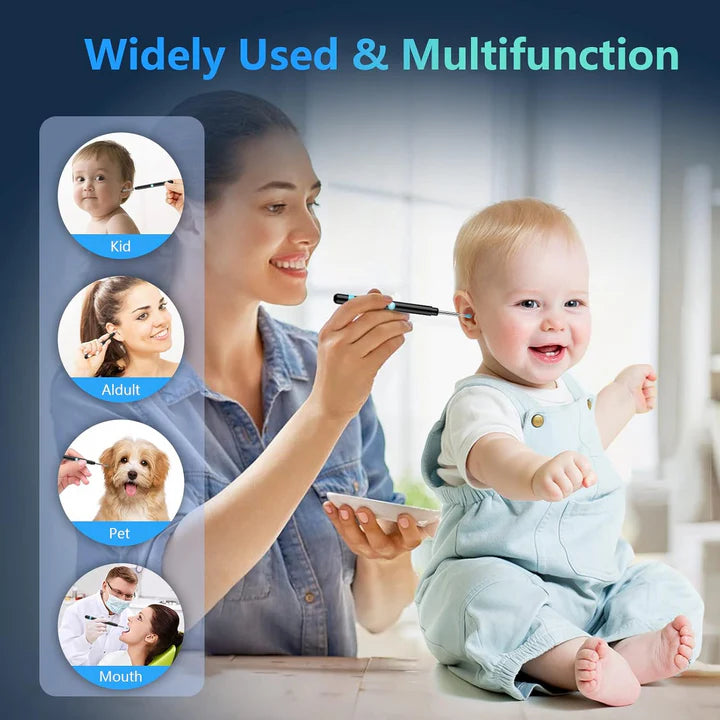 White Ear Wax Removal Tool with Camera – HD Ear Cleaner with 6 LED Lights