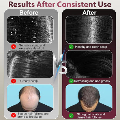 Laser Therapy Hair Growth Comb – Electric Scalp Massager & Hair Oil Applicator Waterproof