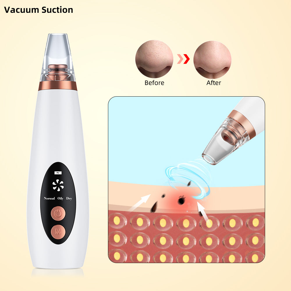 Vacuum Pore Cleaner