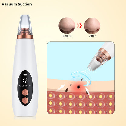Vacuum Pore Cleaner